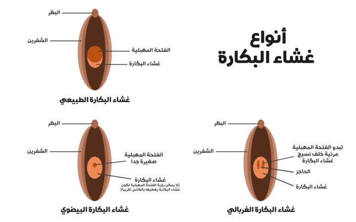 نون بوست